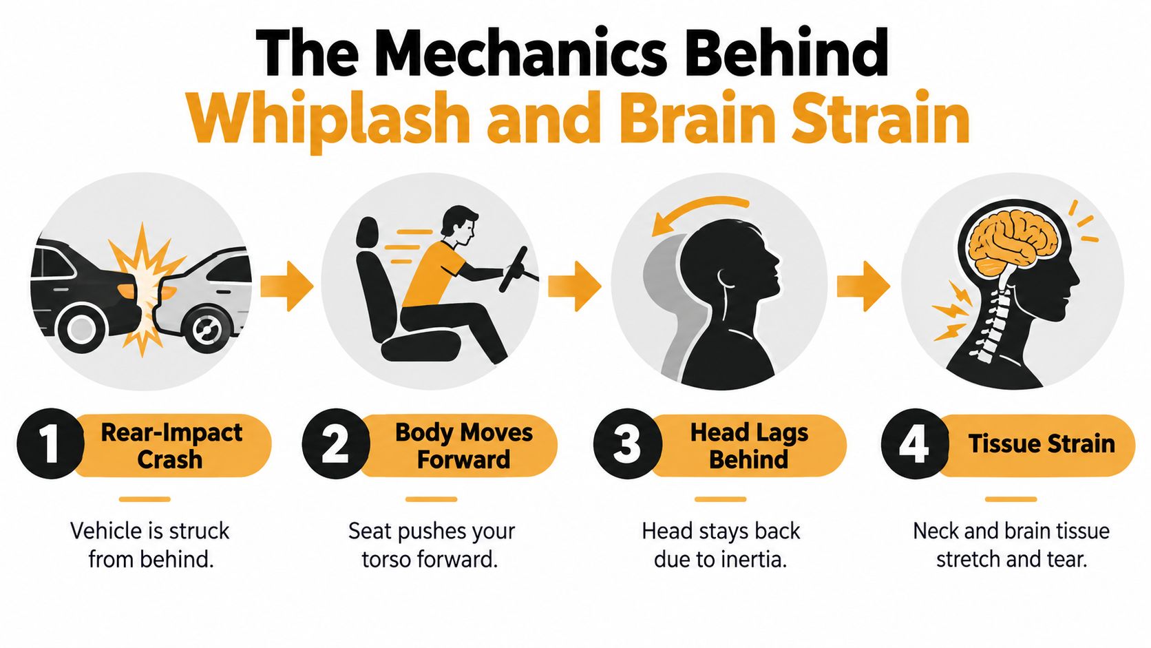 A four-step infographic illustrating how a rear-end car accident causes whiplash and brain strain injuries.